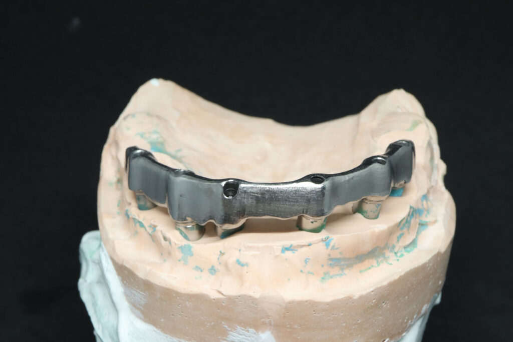 Процесс имплантации Бобков