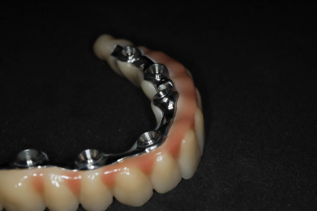 Процесс имплантации Бобков