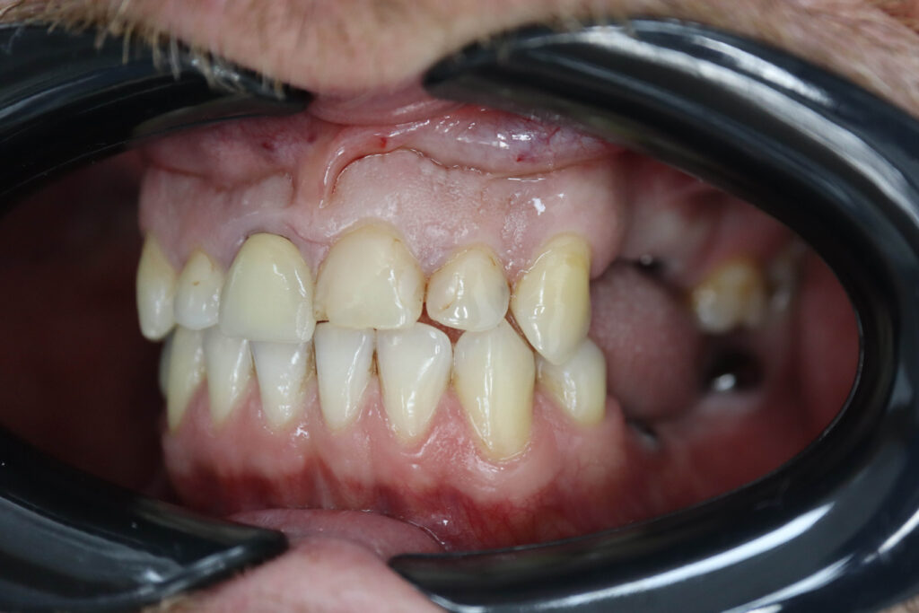 процесс имплантации