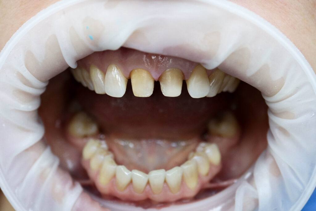 Ситуация до лечения Костюкович