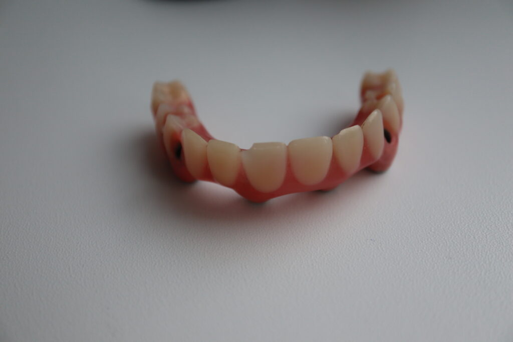 процесс имплантации