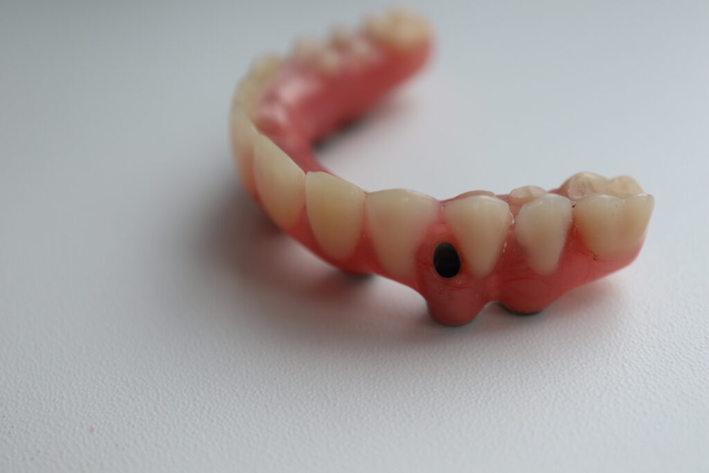 процесс имплантации