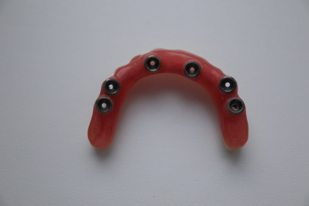 процесс имплантации