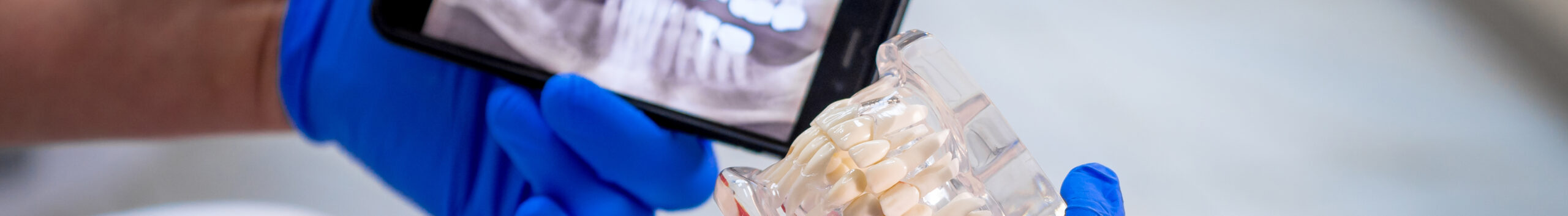 Этапы лечения