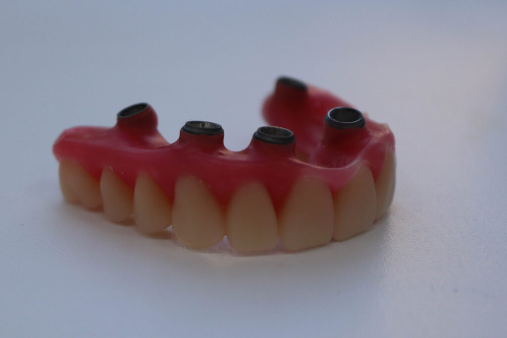 процесс имплантации