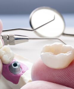 Коронки из металлокерамики