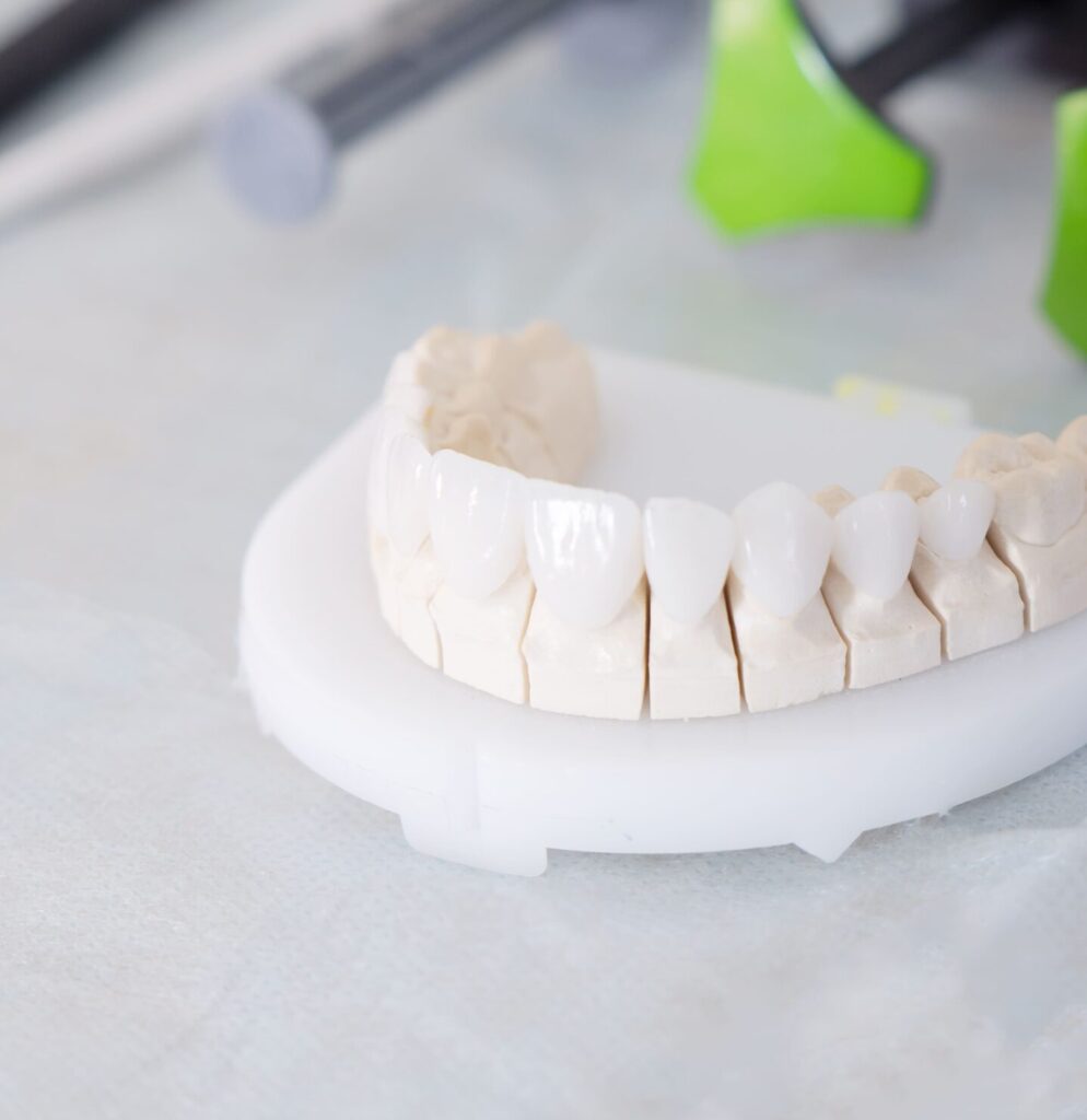 Безметалловые керамические коронки