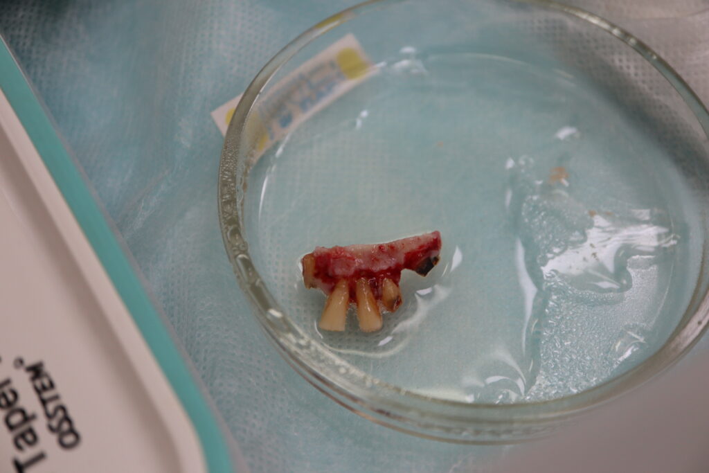 процесс имплантации