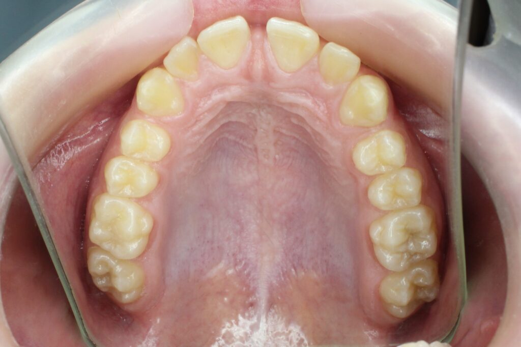 пациент до лечения