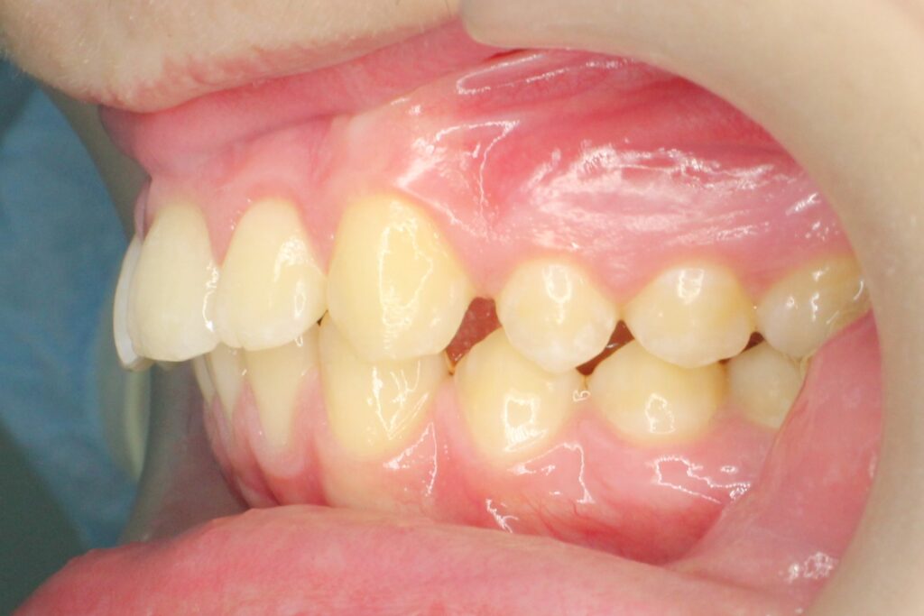 пациент до лечения