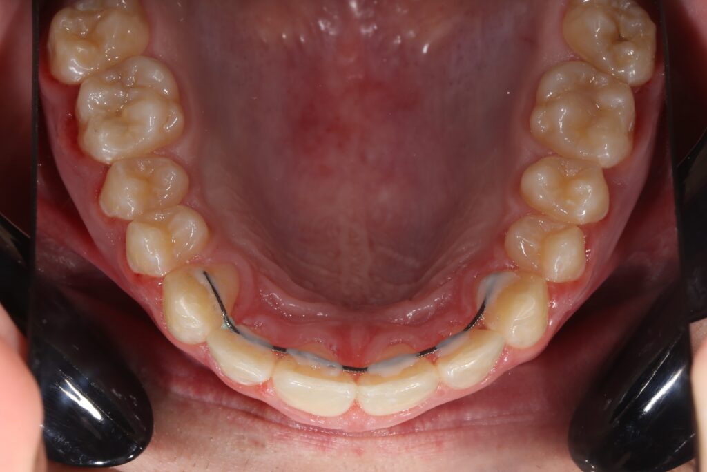 после лечения