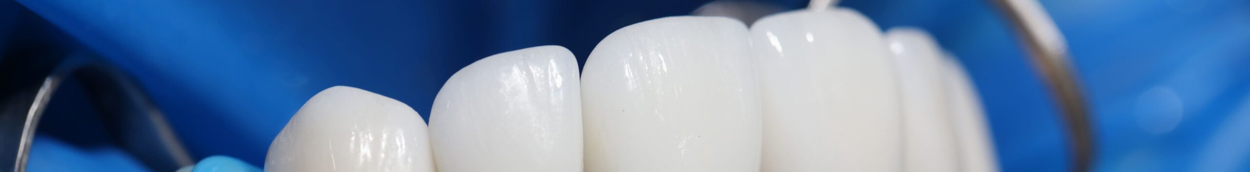 Этапы установки