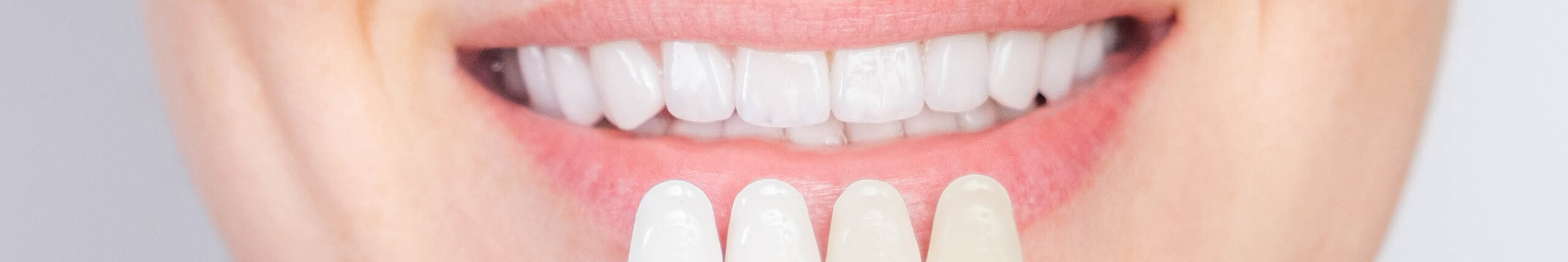 Преимущества и недостатки