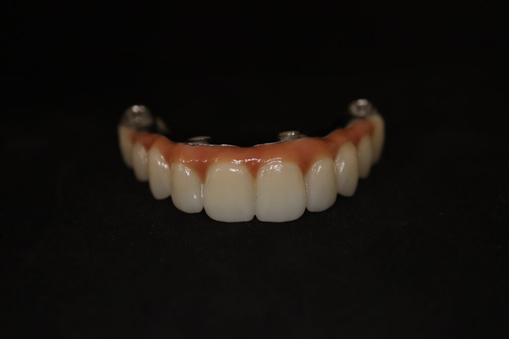 циркониевые протезы Cимпладент