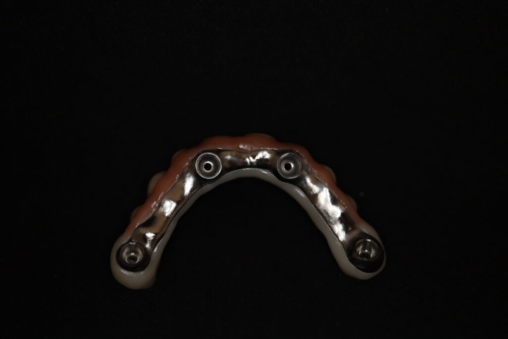 циркониевые протезы Cимпладент