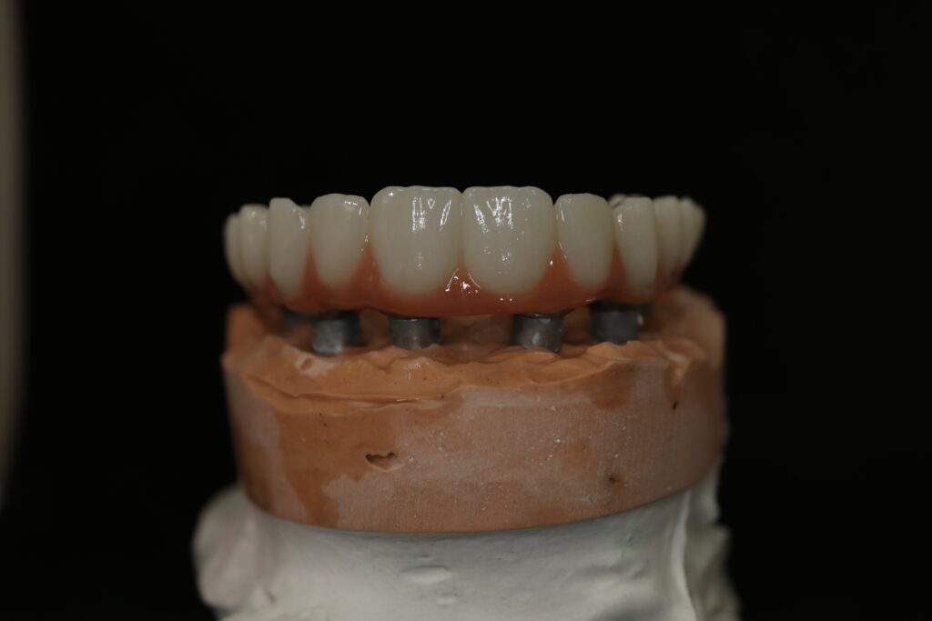 циркониевые протезы Cимпладент