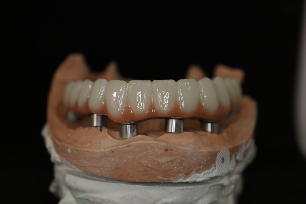 циркониевые протезы Cимпладент