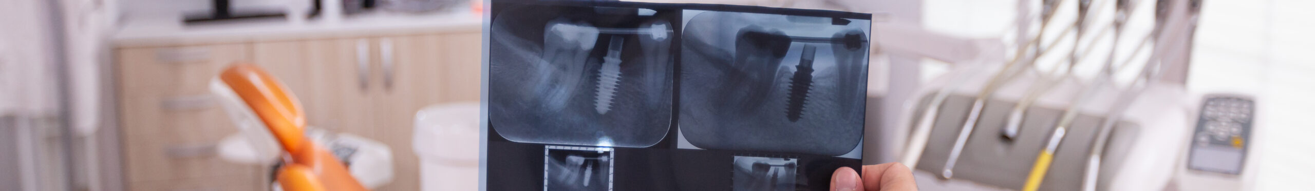 Показания к лечению зубных каналов