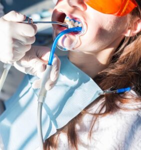 Офисное отбеливание зубов