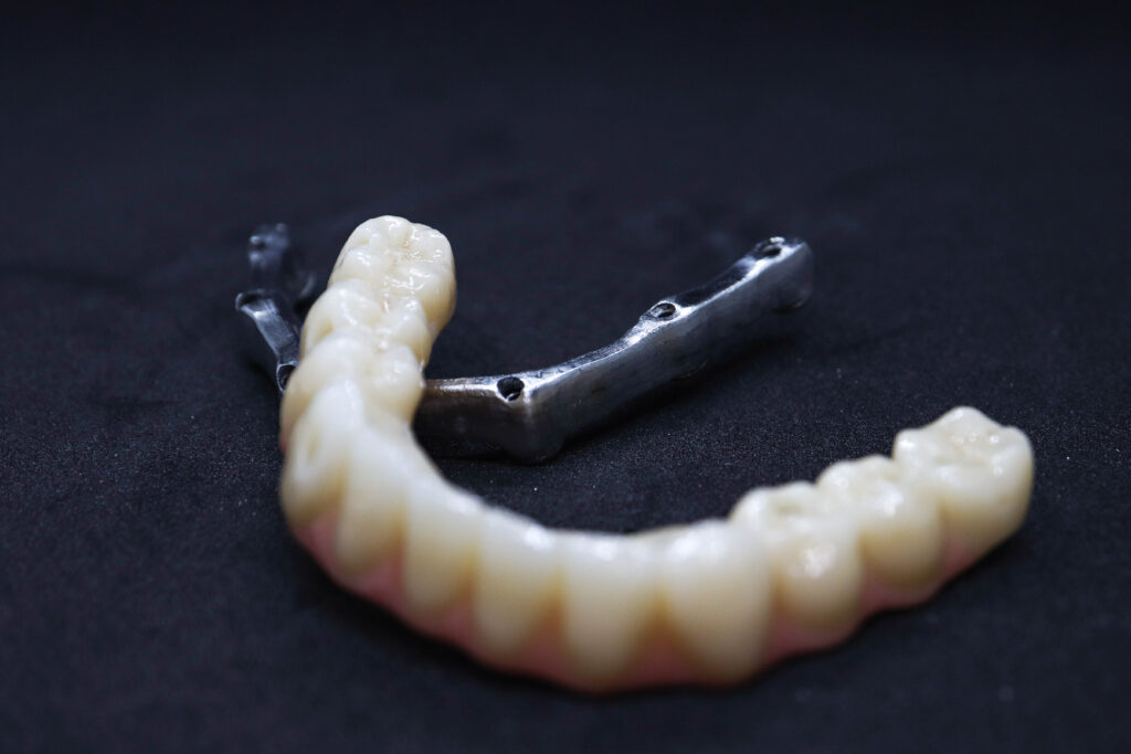 протезы перед установкой