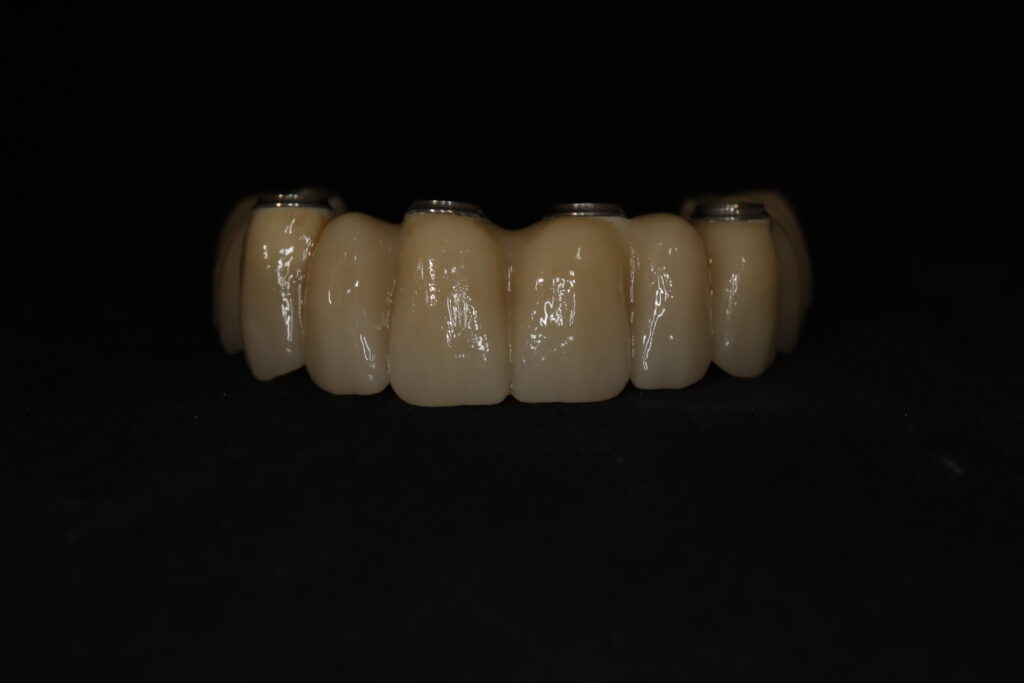 процесс имплантации