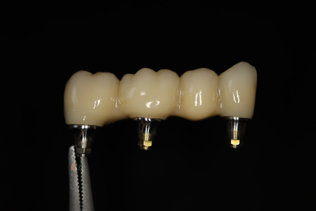 процесс имплантации