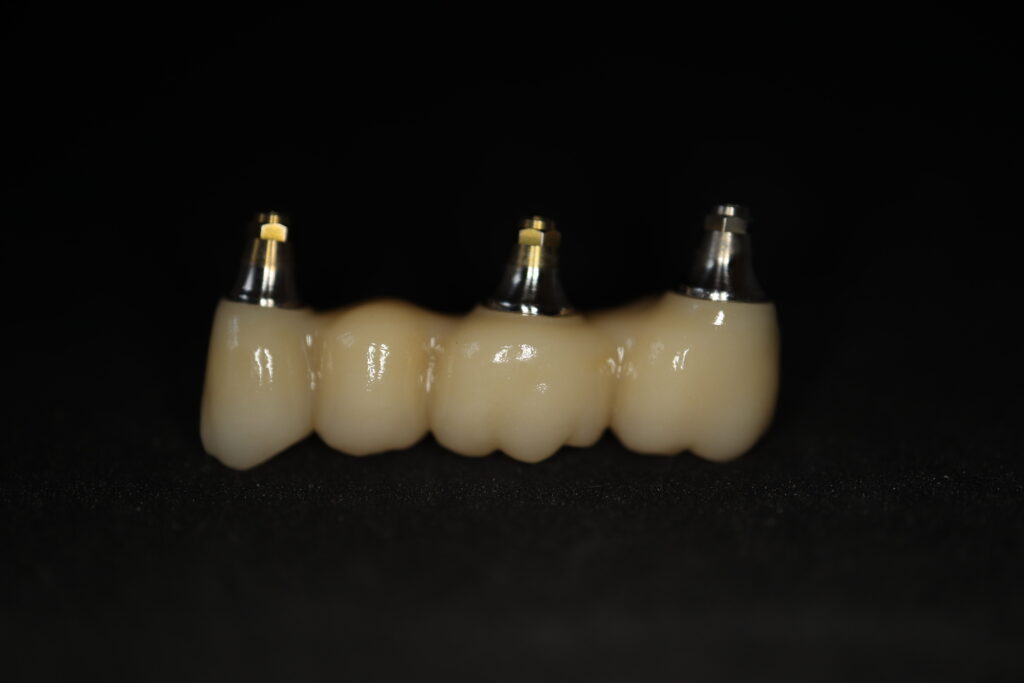 процесс имплантации