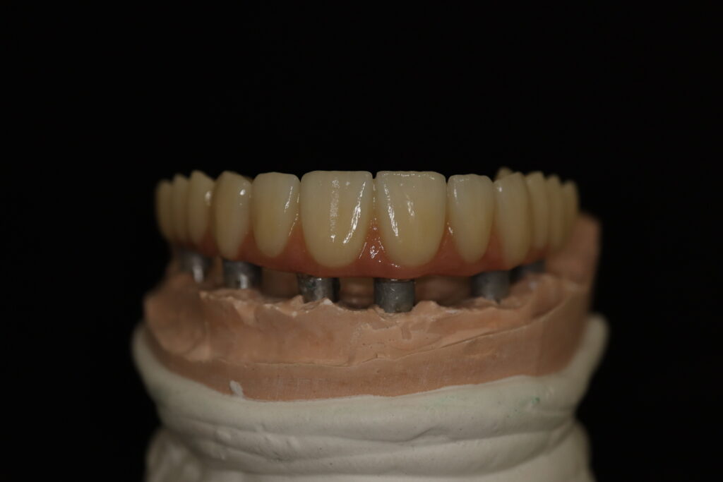 процесс имплантации