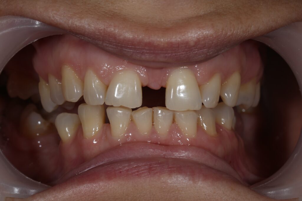 Ситуация до лечения