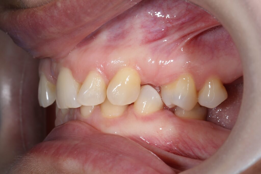 Ситуация до лечения