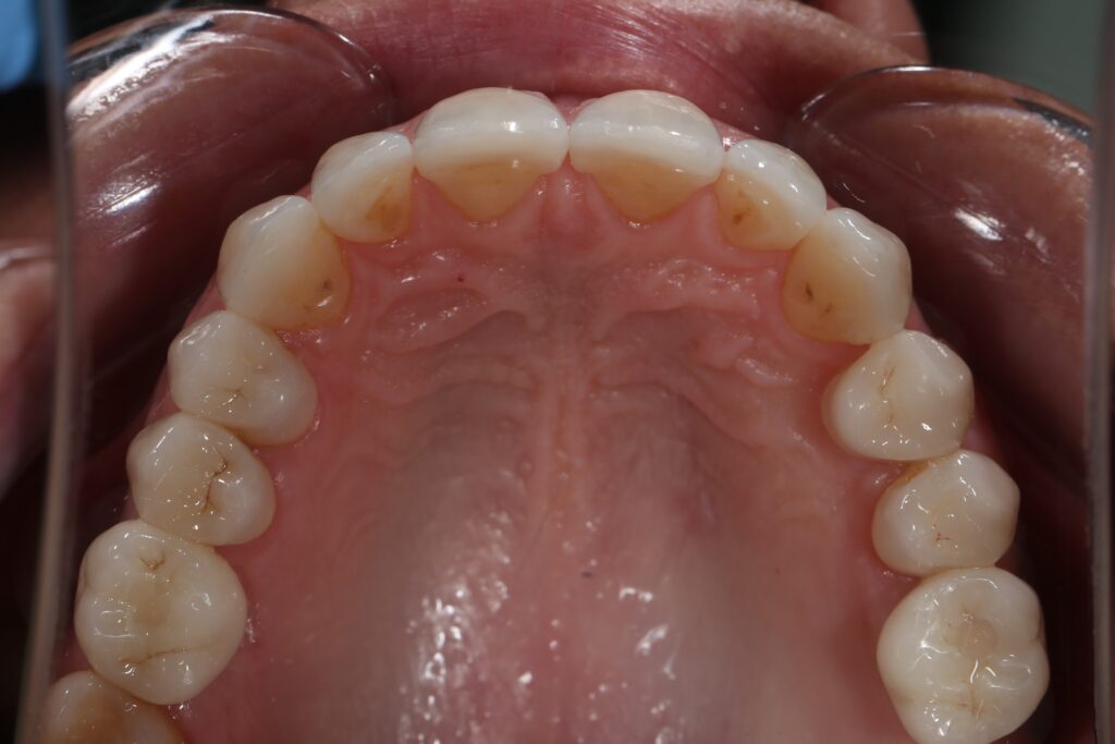 Результаты