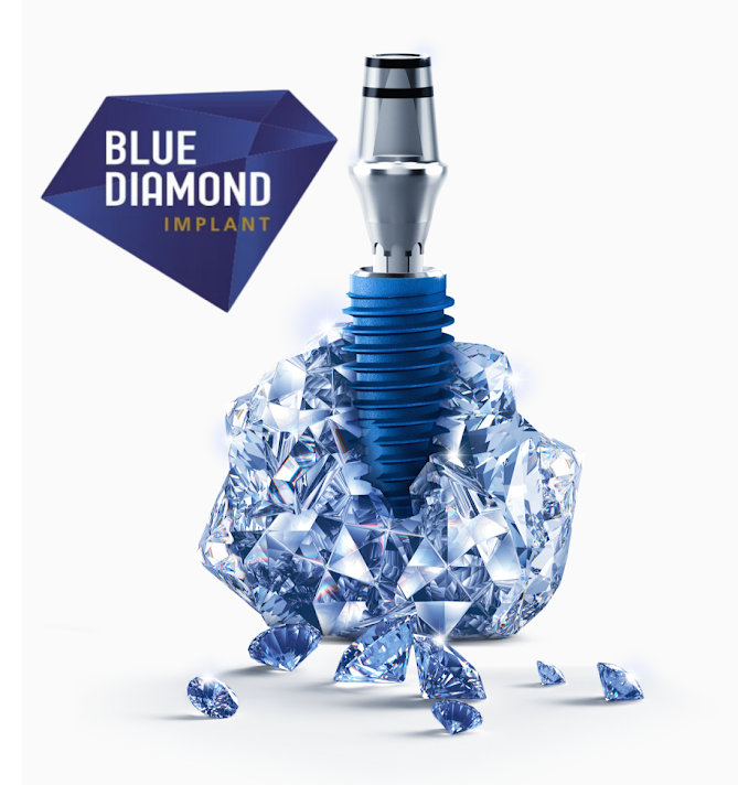 Имплантация зубов Megagen BlueDiamond